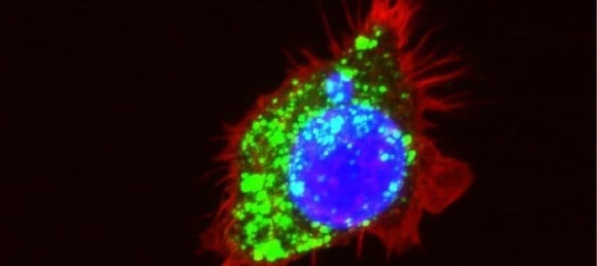 Makrophage_Seiffert_Science_Immunol © DKFZ