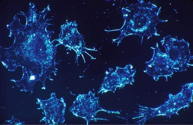 New understanding of why cancer cells move