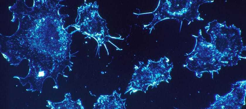 100px-Cancer_cells NCI Dr. Cecil Fox cancer cells