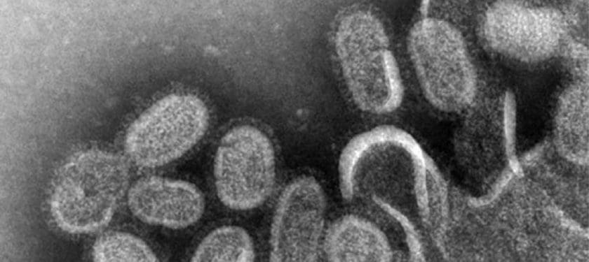 EM_of_influenza_virus 1000 pc EM_of_influenza_virus 1000 pc