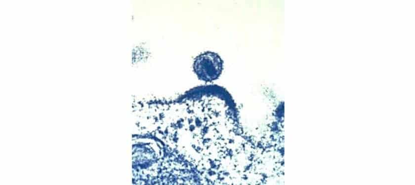 Hiv budding - Public domain NIH 893x443 Hiv budding - Public domain NIH 893x443