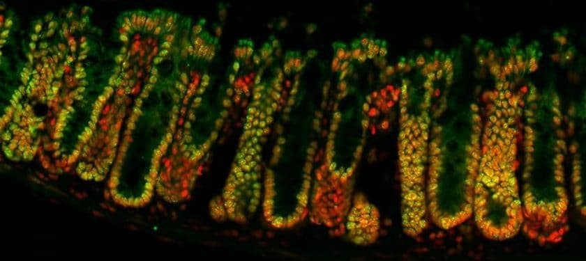 159947_web Credit- Dr Juri Kazakevych, Babraham Institute 159947_web Credit- Dr Juri Kazakevych, Babraham Institute