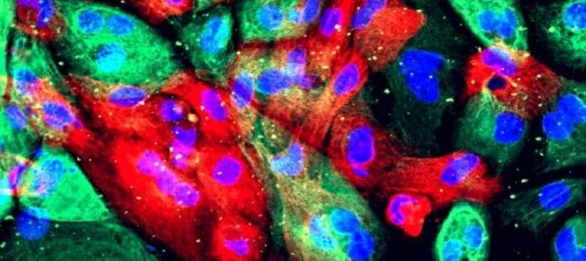 160312_web human prostate cells NCI 900px 160312_web human prostate cells NCI 900px