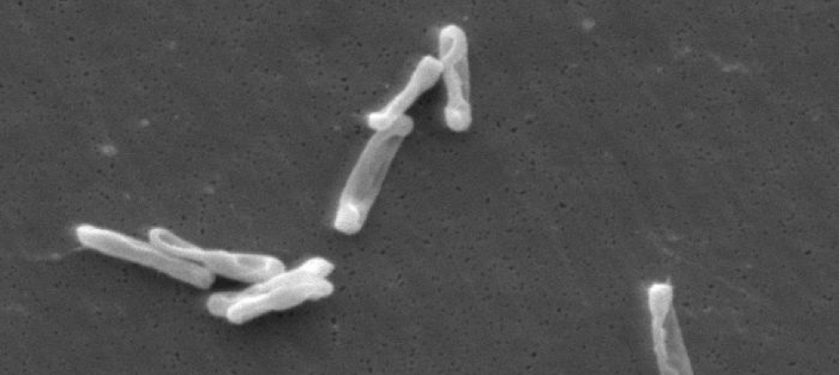 Clostridium_difficile_EM public domain CDC Clostridium_difficile_EM public domain CDC