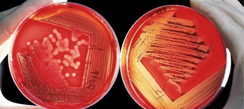agar-60571_1067px CC0 agar-60571_1067px CC0