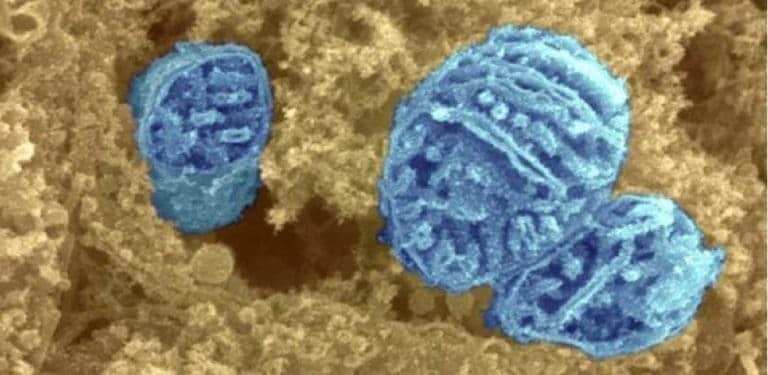 How incurable mitochondrial diseases strike previously unaffected families