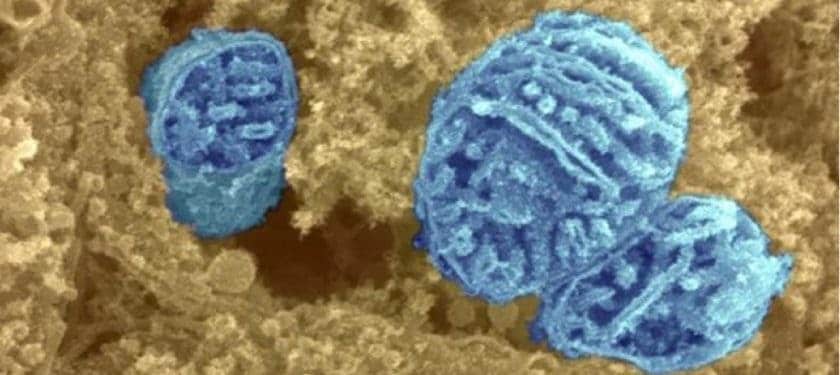djv3w7vf Credit- Dr David Furness Wellcome mitochondria