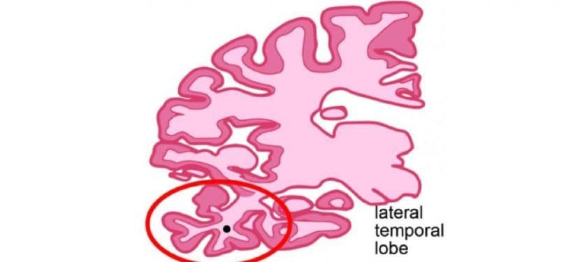 Lat temp lobe - Shelley Berger PhD 919x527 Lat temp lobe - Shelley Berger PhD 919x527