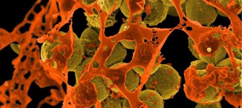 Methicillin-resistant_Staphylococcus_aureus_(MRSA)_Bacteria - NIAID Methicillin-resistant_Staphylococcus_aureus_(MRSA)_Bacteria - NIAID
