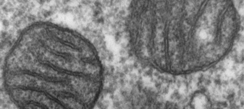 Mitochondria,_mammalian_lung_-_TEM Public Domain Mitochondria,_mammalian_lung_-_TEM Public Domain