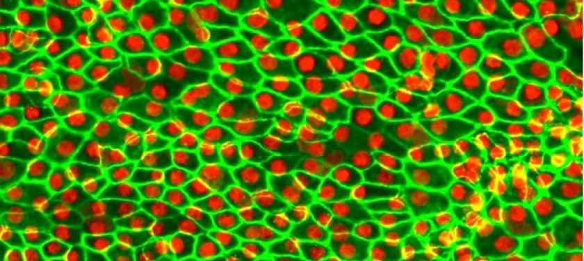 RPE Cells_CROPPED RPE Cells_CROPPED