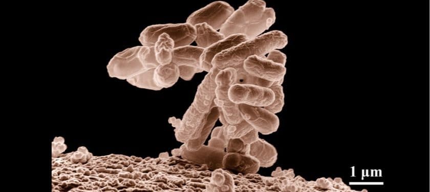 bacteria-62993_1067px CC0 bacteria-62993_1067px CC0