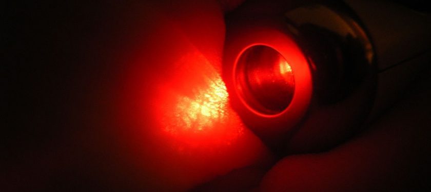 1200px-Red_diode_laser_on_skin 1200px-Red_diode_laser_on_skin