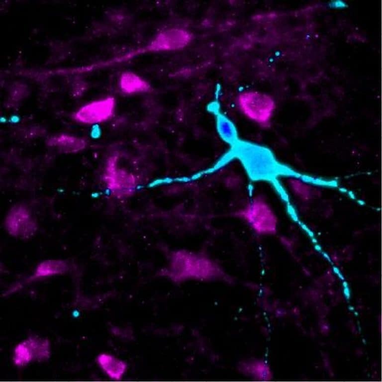 Scientists re-create brain neurons to study obesity and personalize treatment