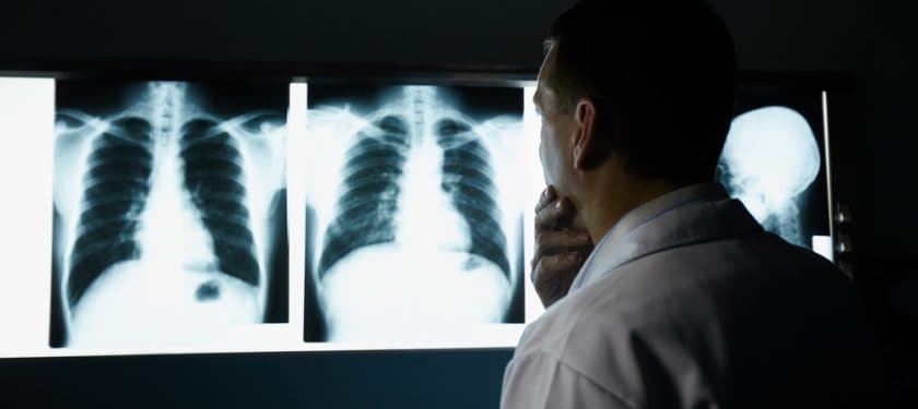Doctor, chest X-ray