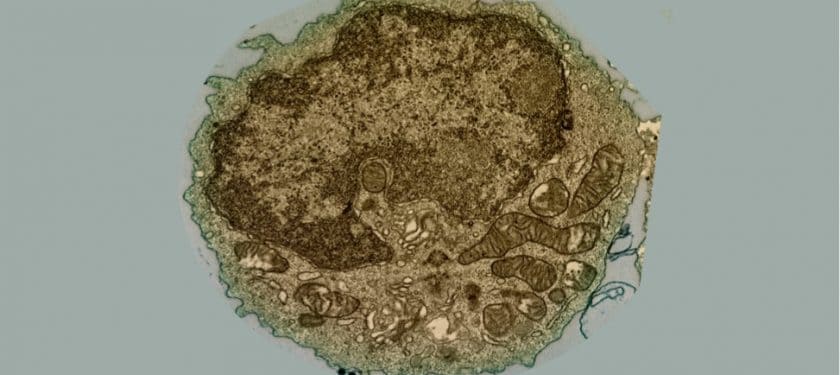 Human_B_Lymphocyte_(28942386960) Human_B_Lymphocyte_(28942386960)