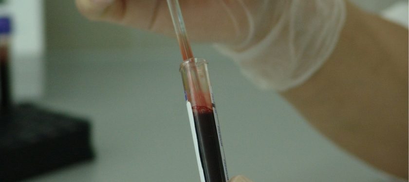 blood-20745_1280 (1) blood-20745_1280 (1)