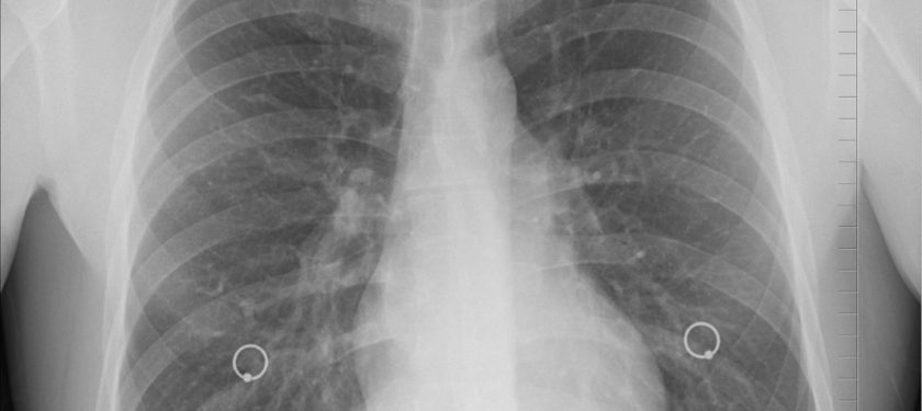 diagnosis-1476620_1067 CC0 diagnosis-1476620_1067 CC0