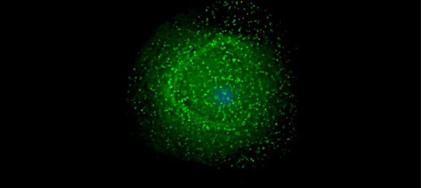 900px-HIV_on_macrophage 900px-HIV_on_macrophage