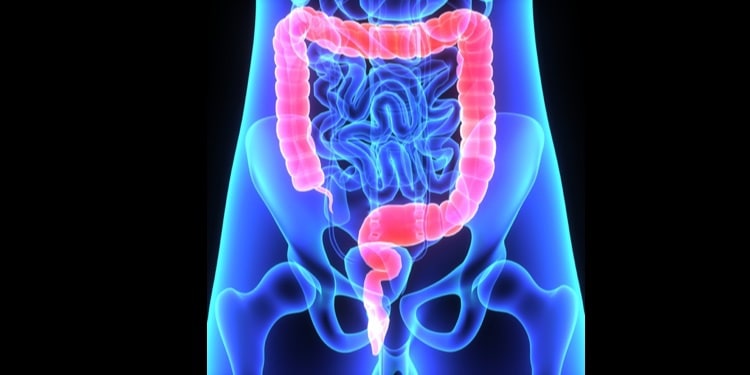 Researchers identify gene that suppresses growth of colorectal cancer tumors