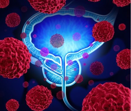Depositphotos_77311998m2015-lightsource prostate, immune system