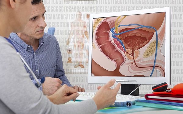 1200px-Prostate_Cancer_(26454931773) 1200px-Prostate_Cancer_(26454931773)
