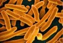 E. coli superbug strains can persist in healthy women's guts