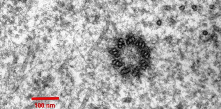 Spindle_centriole_-_embryonic_brain_mouse_-_TEM Spindle_centriole_-_embryonic_brain_mouse_-_TEM