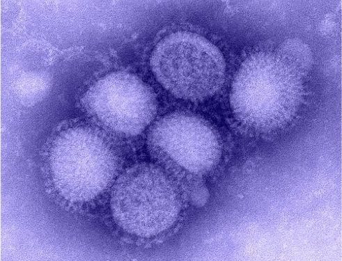 408px-H1N1_influenza_virus - cdc 408px-H1N1_influenza_virus - cdc