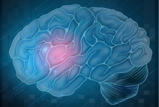 Depositphotos_17819065_s-2015-blueringmedia brain