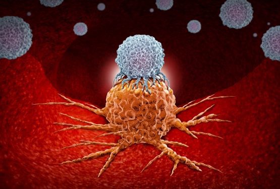 Depositphotos_203223076_m-2015-lightsource immunotherapy