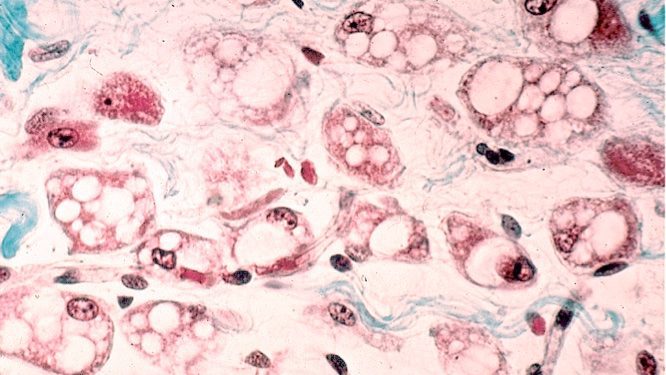 Tecido_adiposo_multilocular_brown_adipose_tissue Brown adipose tissue, brown fat