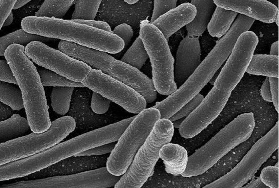 571px-EscherichiaColi_NIAID - B 571px-EscherichiaColi_NIAID - B
