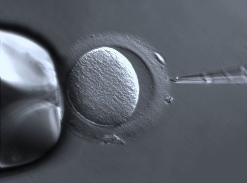 606px-Oocyte_with_Zona_pellucida_(27771482282) 606px-Oocyte_with_Zona_pellucida_(27771482282)