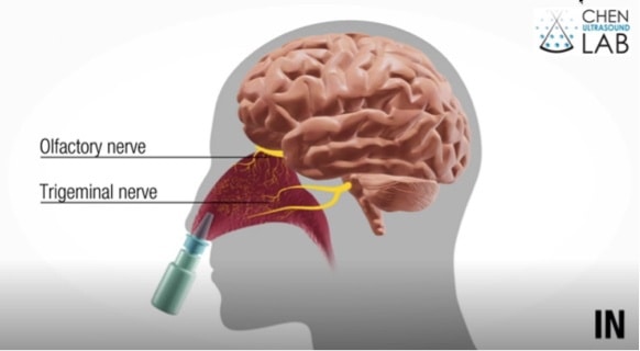 Brain Drug Delivery - Washington University St Louis Brain Drug Delivery - Washington University St Louis