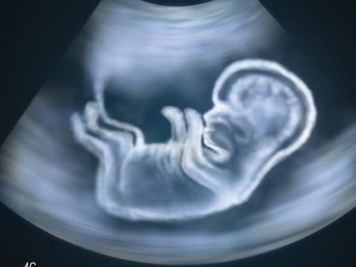 Depositphotos_7245229_m-2015-Alexmit fetus, ultrasound scan