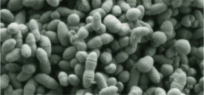Ruminococcus gnavus Ruminococcus gnavus