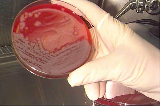 Breakthrough test screens for all known bacterial infections – BioNews ...
