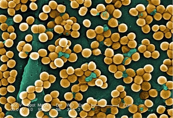 Researchers cure drug-resistant bacterial infections without antibiotics