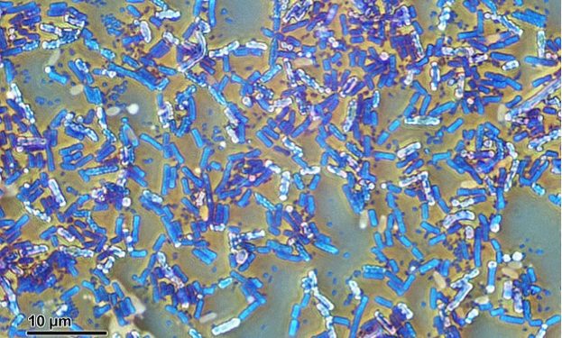640px-Eubacteria_(26_2_87)_Bacillus_subtilis;_spores_stained_green 640px-Eubacteria_(26_2_87)_Bacillus_subtilis;_spores_stained_green