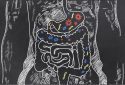 Gut microbes may affect the course of ALS
