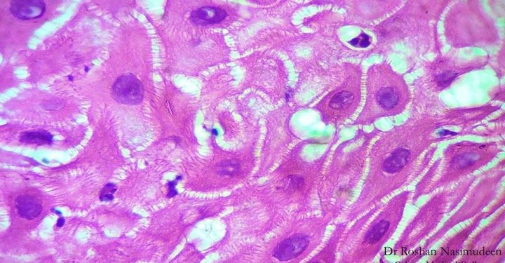 Keratinocytes_in_spinous_layer_of_epidermis Keratinocytes_in_spinous_layer_of_epidermis