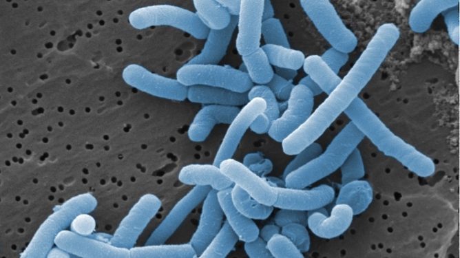 Lactobacillus_paracasei Lactobacillus_paracasei
