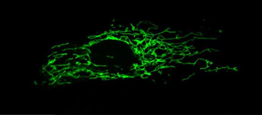 mitochondria_image_richter -PAULA MARTTINEN mitochondria_image_richter -PAULA MARTTINEN
