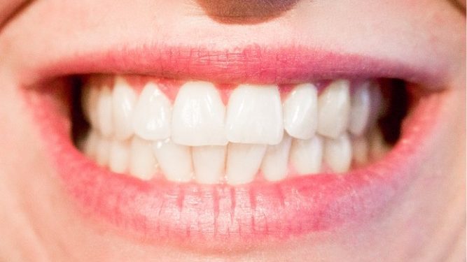 teeth-1652976_640 teeth-1652976_640