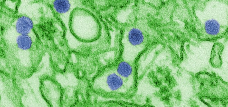 480px-Zika_EM_CDC_20541 480px-Zika_EM_CDC_20541