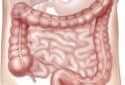 Aspirin appears to curb colorectal cancer recurrence and tumor growth