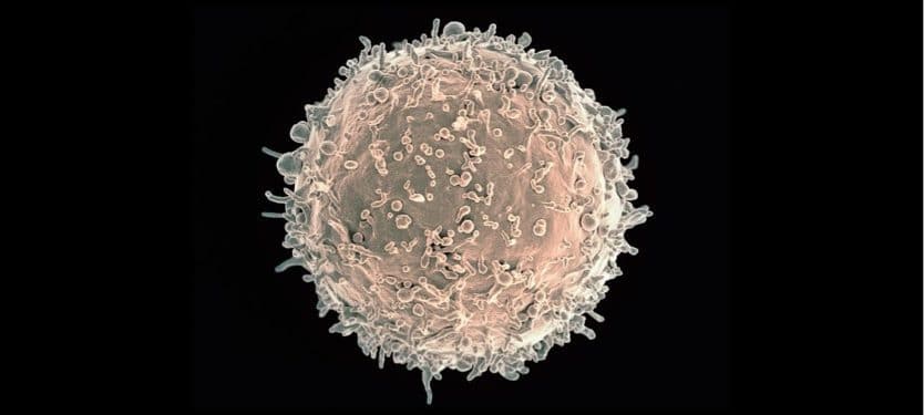 640px-Human_B_Lymphocyte_-_NIAID B lymphocyte, B cell