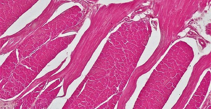 640px-Muscle_Tissue_Cross_Section_Whole_Skeletal_Muscle_(28089115828) 640px-Muscle_Tissue_Cross_Section_Whole_Skeletal_Muscle_(28089115828)