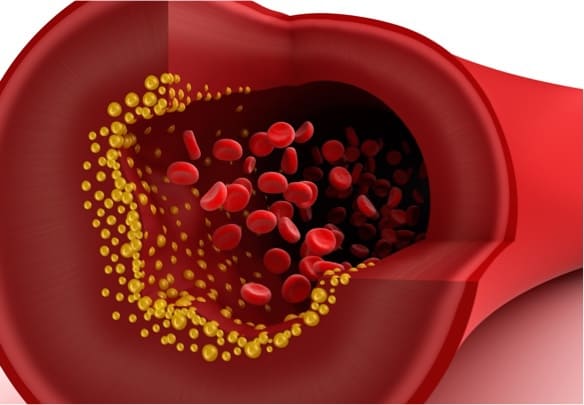 Observation of blood vessel cell changes could help early detection of blocked arteries